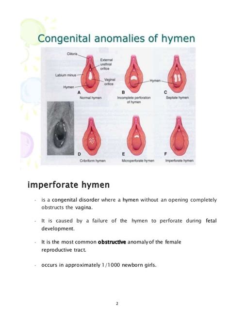 defloration of hymen|Diagnosis and Management of Hymenal Variants .